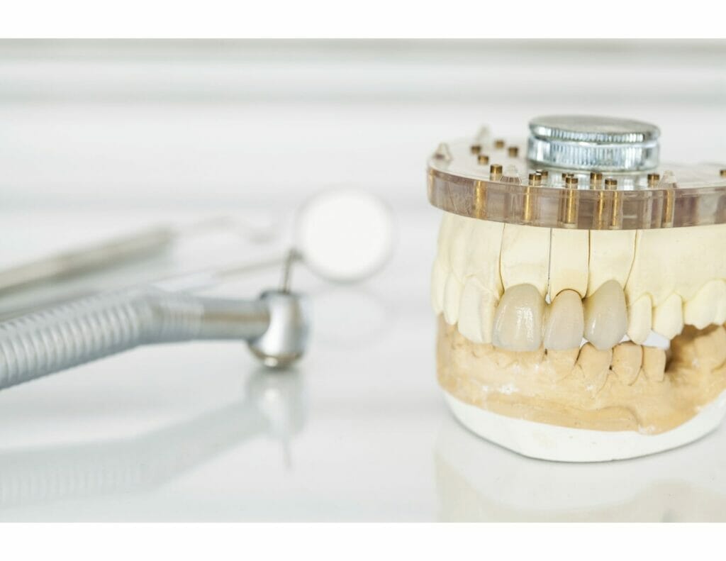 dental bridge near me