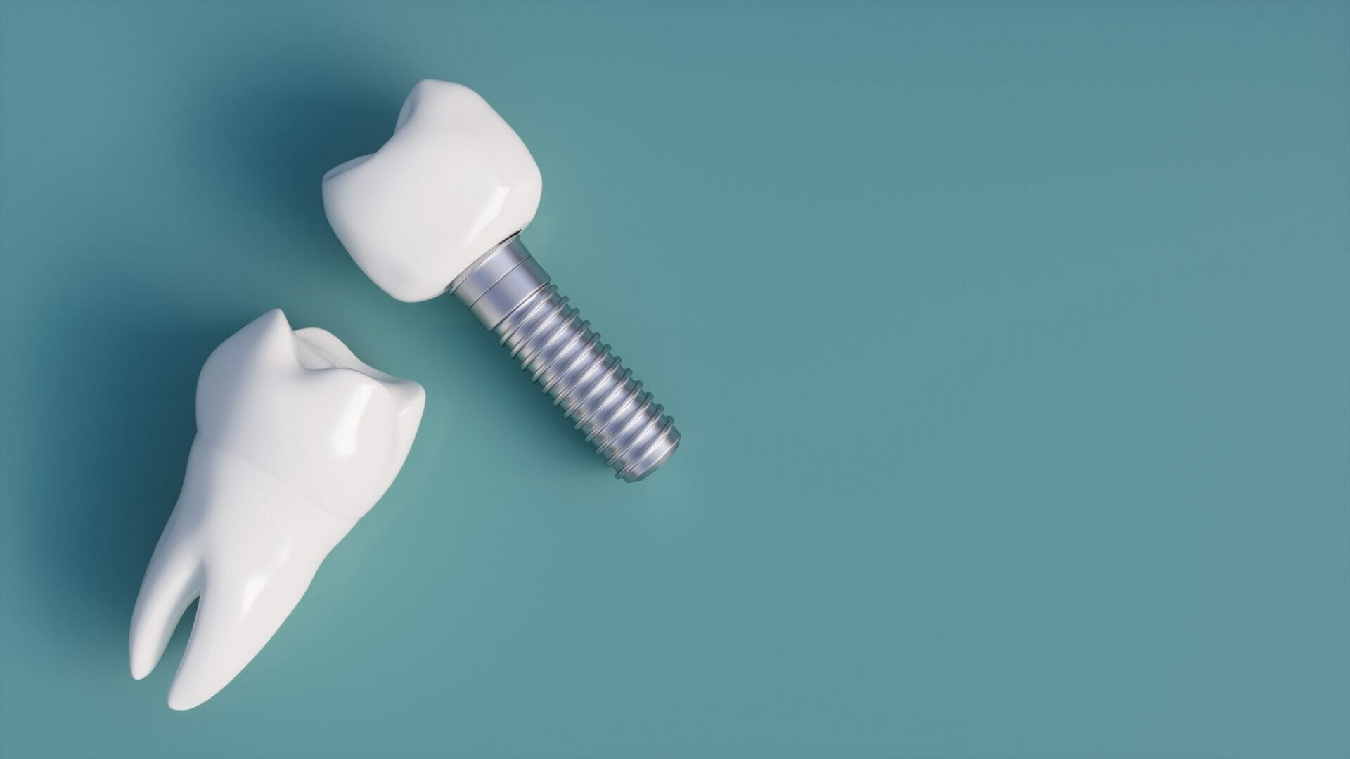 How much do Dental Implants Cost? - ENAMEL REPUBLIC