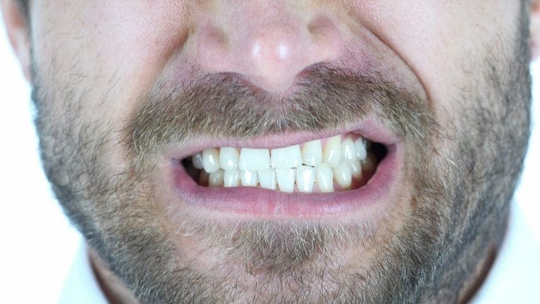 gum recession from grinding teeth