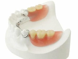 Partial dentures in Kitchener
